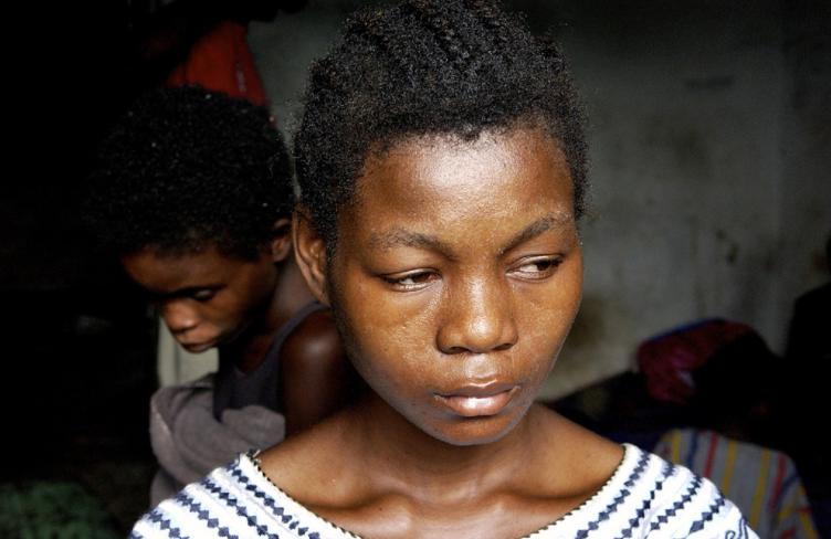 patient at psychiatric facility liberia.jpg patient at psychiatric facility liberia.jpg